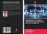 Reabilitaç?o protética suportada por implantes em arco completo