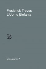 uomo elefante