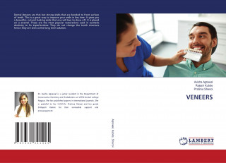 VENEERS
