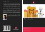 Extrus?o Apical