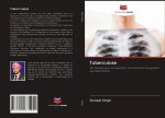 Tuberculose