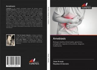 Amebiasis