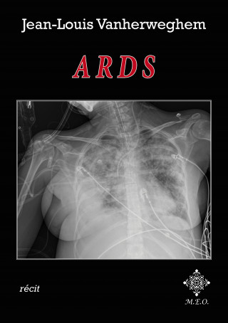 Ards