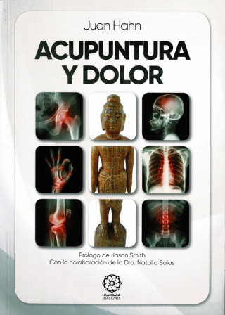 Acupuntura y dolor