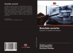 Bouchée ouverte