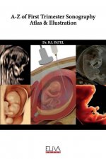 A-Z of First Trimester Sonography Atlas & Illustration