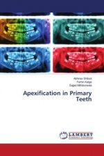 Apexification in Primary Teeth