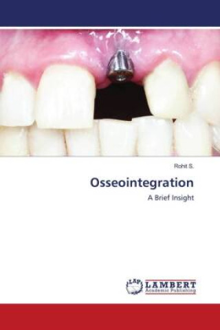 Osseointegration