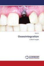 Osseointegration
