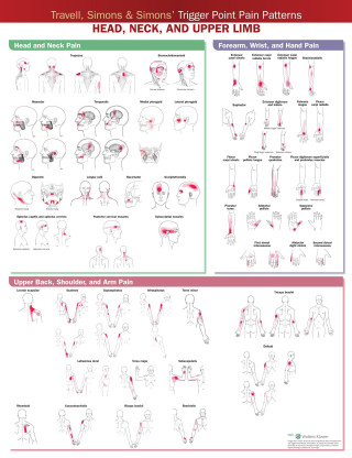 Travell, Simons & Simons' Trigger Point Pain Patterns Wall Chart