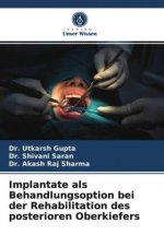 Implantate als Behandlungsoption bei der Rehabilitation des posterioren Oberkiefers