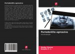Periodontite agressiva