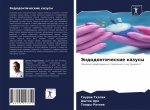 Эндодонтические казусы