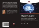 Segmentation des tumeurs cerebrales a l'aide de la technologie d'impression 3D