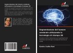 Segmentazione del tumore cerebrale utilizzando la tecnologia di stampa 3D