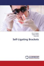 Self-Ligating Brackets