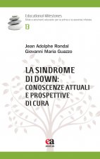 sindrome di Down: conoscenze attuali e prospettive di cura