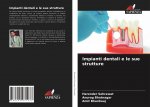 Impianti dentali e le sue strutture