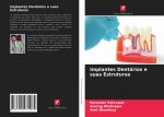 Implantes Dentarios e suas Estruturas