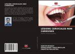 Lesions Cervicales Non Carieuses