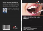 Lesioni Cervicali Non Cariose