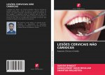 Lesoes Cervicais Nao Cariocas