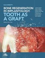 Bone regeneration in implantology - tooth as a graft