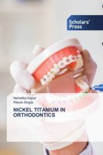 Nickel Titanium in Orthodontics
