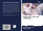 Поражение стопы при гона