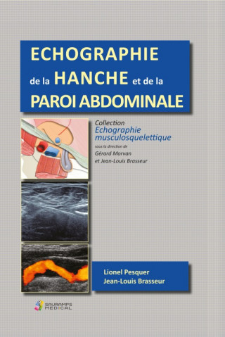 ECHOGRAPHIE DE  LA HANCHE ET DE LA PAROI ABDOMINALE