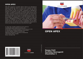 Open Apex