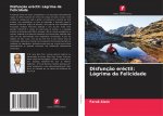 Disfuncao erectil