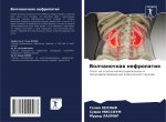 Волчаночная нефропатия