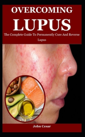 Overcoming Lupus
