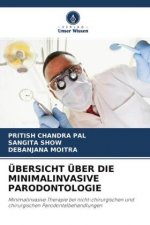 UEbersicht UEber Die Minimalinvasive Parodontologie