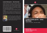 Lesao Endo-perio - Uma Revisao