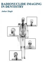 Radionuclide Imaging in Dentistry