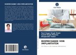 Biomechanik Von Implantaten