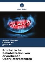Prothetische Rehabilitation von erworbenen Oberkieferdefekten