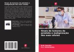 Sinais de tumores da prostata e malignizacao das suas celulas