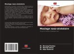 Moulage naso-alveolaire