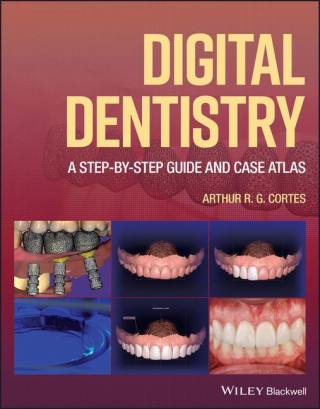 Digital Dentistry: A Step-by-Step Guide and Case A tlas