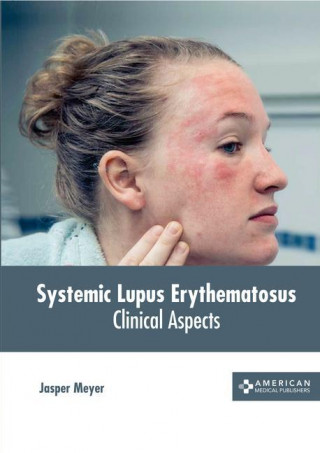 Systemic Lupus Erythematosus: Clinical Aspects