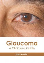 Glaucoma: A Clinician's Guide