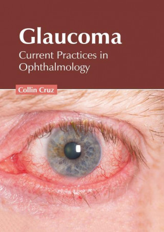 Glaucoma: Current Practices in Ophthalmology