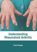 Understanding Rheumatoid Arthritis