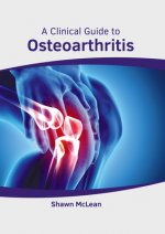 Clinical Guide to Osteoarthritis