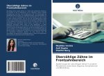 Überzählige Zähne im Frontzahnbereich