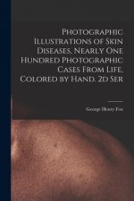 Photographic Illustrations of Skin Diseases, Nearly One Hundred Photographic Cases From Life, Colored by Hand. 2d Ser