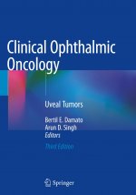 Clinical Ophthalmic Oncology: Uveal Tumors